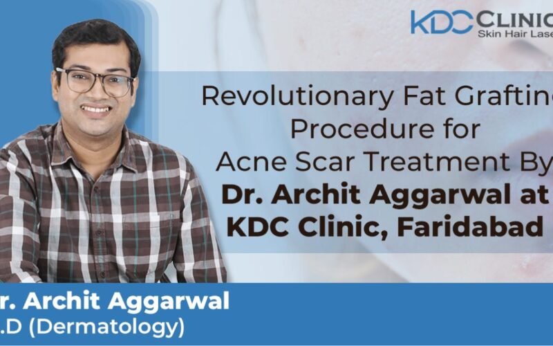 Dr. Archit Agarwal of KDC Clinic Faridabad Revolutionizes Acne Scar Treatment with Innovative Fat Grafting Procedure