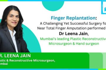 Finger Replantation, A Challenging Yet Successful Surgery for Near Total Finger Amputation performed by Dr. Leena Jain, Mumbai’s leading Plastic Reconstructive Microsurgeon & Hand surgeon